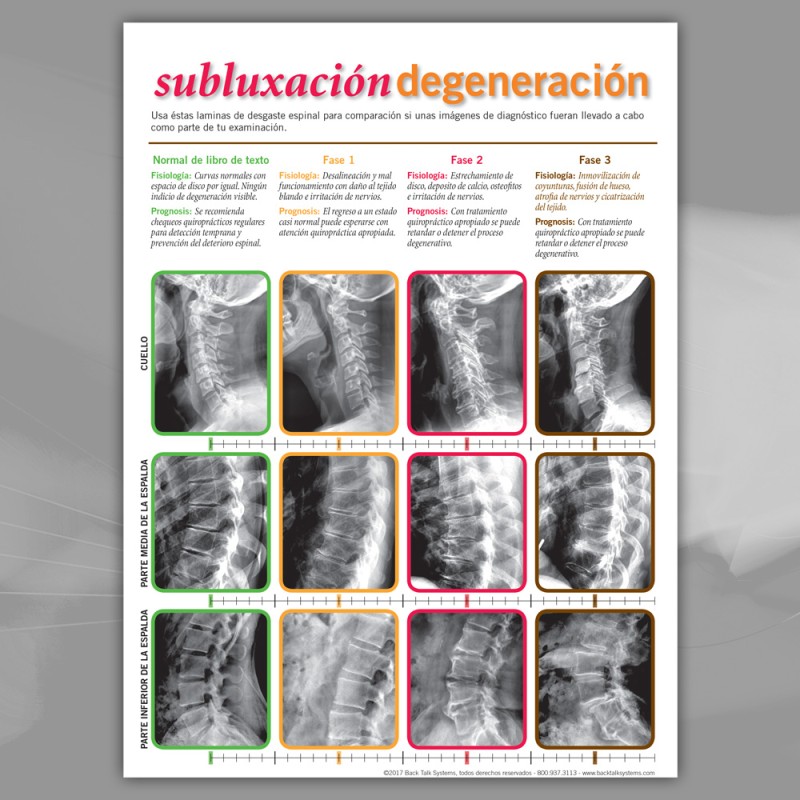 裁断済　脊椎脊髄病学 = PRINCIPLES OF SPINAL DISOR Back Talk Systems » Spanish Spinal Degeneration Handout